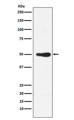 Anti-FOXL2 Rabbit Monoclonal Antibody Boster Bio