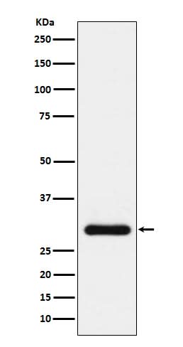 Anti-BNP Rabbit Monoclonal Antibody Boster Bio