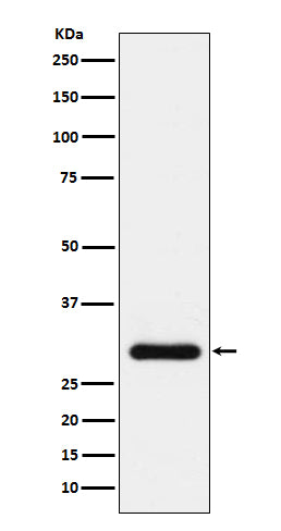 Anti-BNP Rabbit Monoclonal Antibody Boster Bio