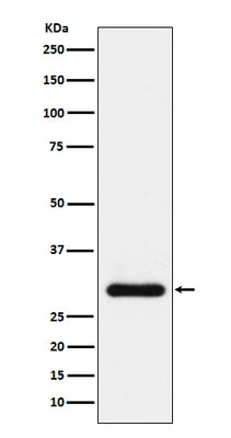 Anti-BNP Rabbit Monoclonal Antibody Boster Bio