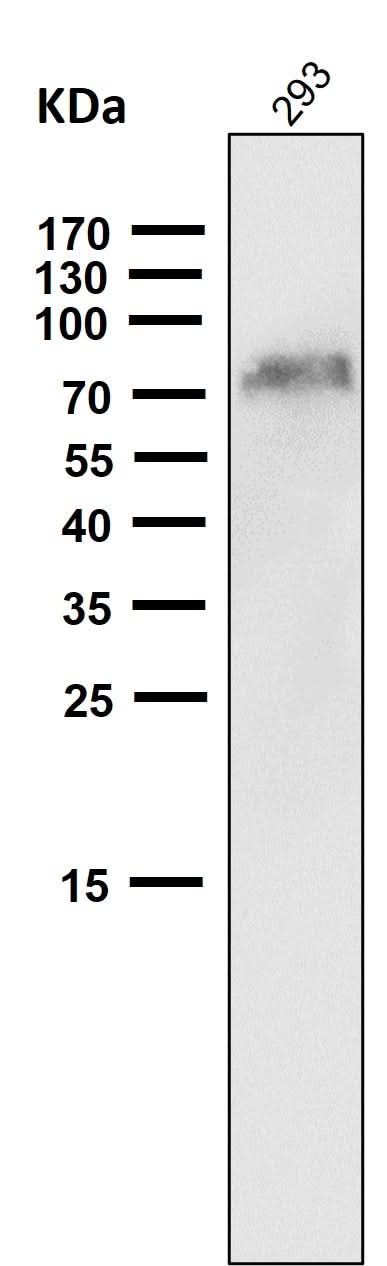 Anti-NGFR/P75 Rabbit Monoclonal Antibody Boster Bio