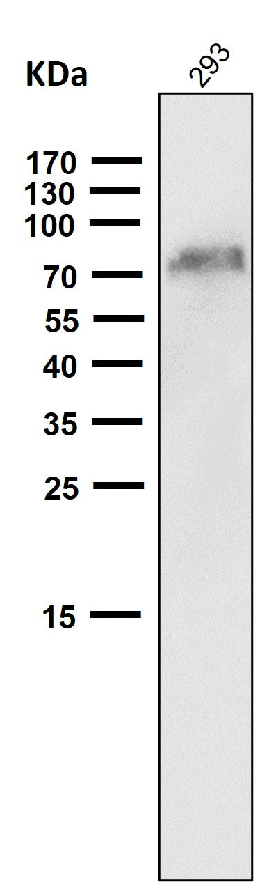 Anti-NGFR/P75 Rabbit Monoclonal Antibody Boster Bio