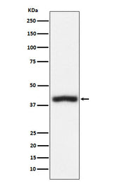 Anti-CD1c Rabbit Monoclonal Antibody Boster Bio