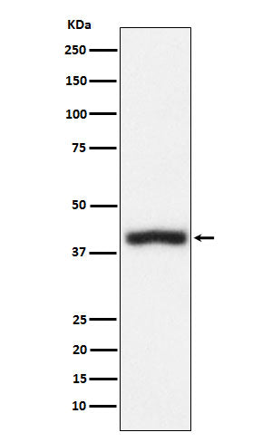 Anti-CD1c Rabbit Monoclonal Antibody Boster Bio