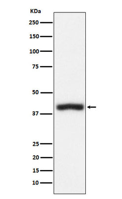 Anti-CD1c Rabbit Monoclonal Antibody Boster Bio