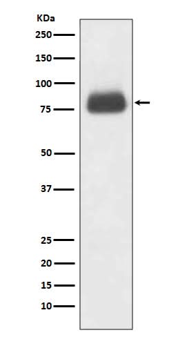 Anti-CD36/Sr B3 Rabbit Monoclonal Antibody Boster Bio