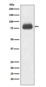 Anti-CD36/Sr B3 Rabbit Monoclonal Antibody Boster Bio