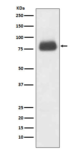 Anti-CD36/Sr B3 Rabbit Monoclonal Antibody Boster Bio