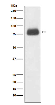 Anti-CD36/Sr B3 Rabbit Monoclonal Antibody Boster Bio