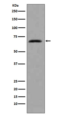 Anti-CDC7 Rabbit Monoclonal Antibody Boster Bio