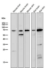 Anti-Choline Acetyltransferase Rabbit Monoclonal Antibody Boster Bio