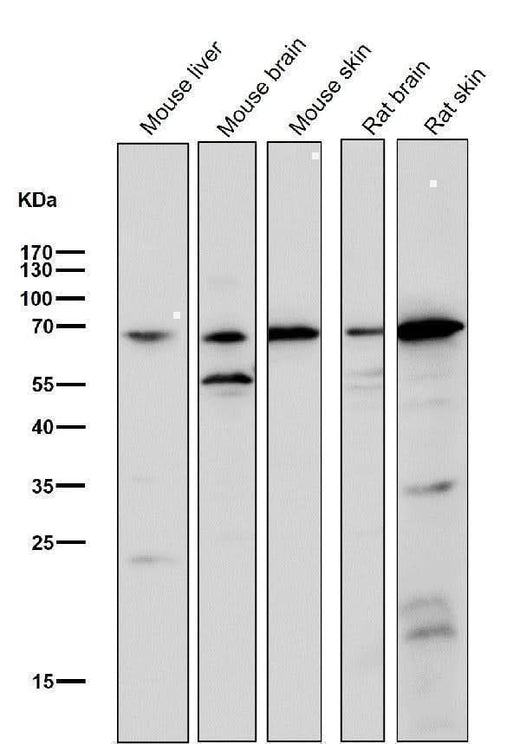 Anti-Choline Acetyltransferase Rabbit Monoclonal Antibody Boster Bio