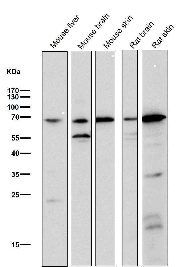 Anti-Choline Acetyltransferase Rabbit Monoclonal Antibody Boster Bio