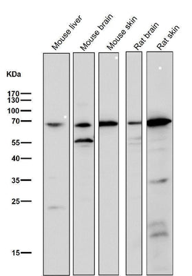 Anti-Choline Acetyltransferase Rabbit Monoclonal Antibody Boster Bio