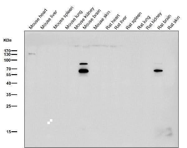 Anti-CHAT/Choline Acetyltransferase Rabbit Monoclonal Antibody Boster Bio