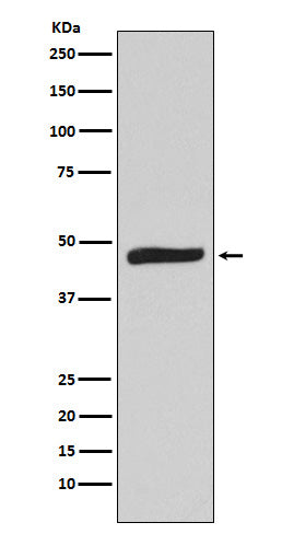 Anti-MAPKAP Kinase 2 Rabbit Monoclonal Antibody Boster Bio