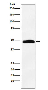 Anti-MAPKAP Kinase 2 Rabbit Monoclonal Antibody Boster Bio