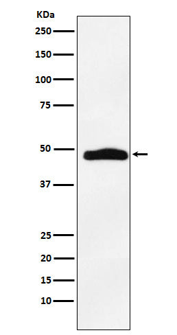 Anti-MAPKAP Kinase 2 Rabbit Monoclonal Antibody Boster Bio