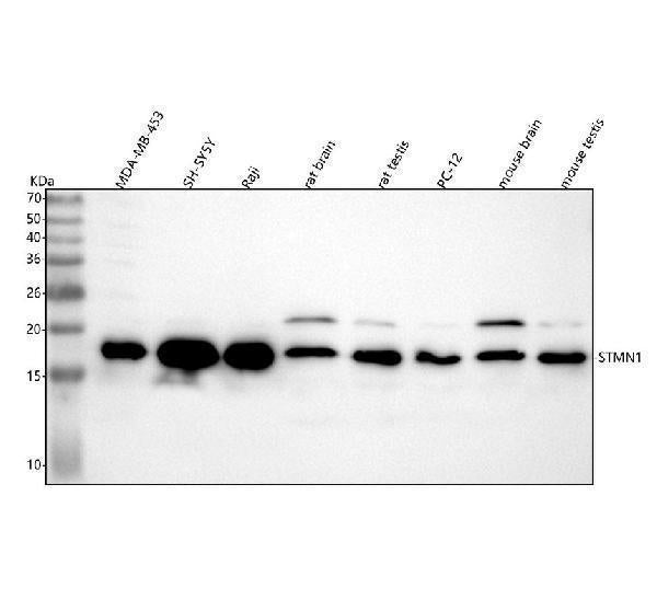 Anti-Stathmin 1 STMN1 Rabbit Monoclonal Antibody Boster Bio