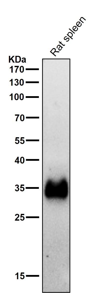 Anti-HLA-DRA/Hla Dr Rabbit Monoclonal Antibody Boster Bio