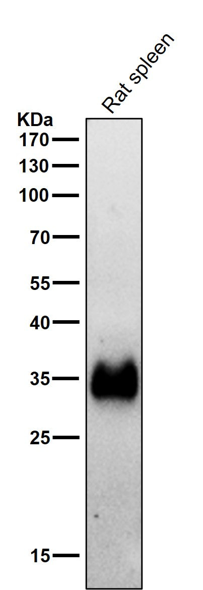 Anti-HLA-DRA/Hla Dr Rabbit Monoclonal Antibody Boster Bio