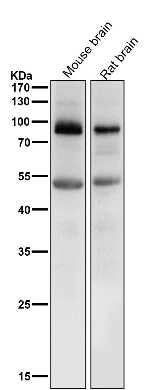 Anti-Prolactin Receptor Rabbit Monoclonal Antibody Boster Bio