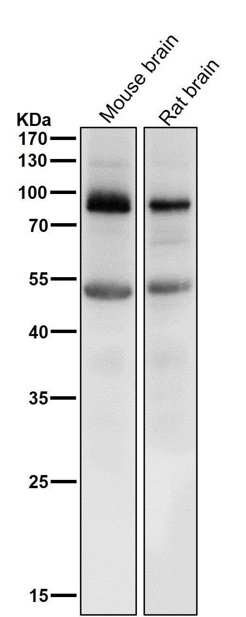 Anti-Prolactin Receptor Rabbit Monoclonal Antibody Boster Bio