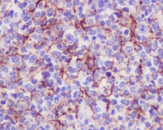 Anti-VCAM1/Cd106 Rabbit Monoclonal Antibody Boster Bio
