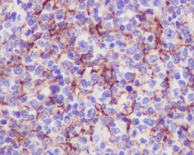 Anti-VCAM1/Cd106 Rabbit Monoclonal Antibody Boster Bio