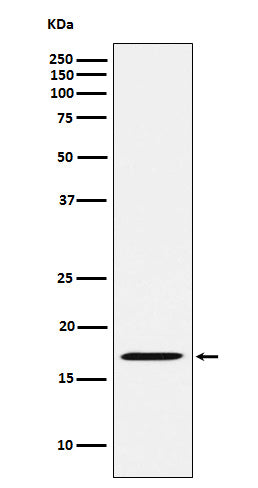 Anti-FHIT Rabbit Monoclonal Antibody Boster Bio