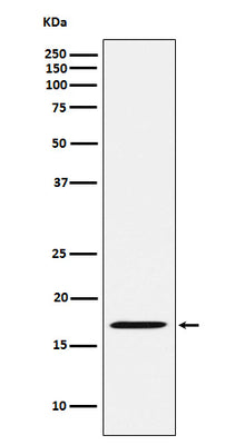 Anti-FHIT Rabbit Monoclonal Antibody Boster Bio