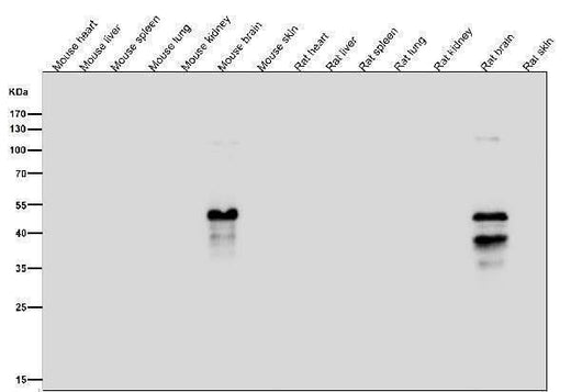 Anti-Phospho-MAP2 (S136) Rabbit Monoclonal Antibody Boster Bio