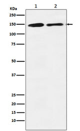 Anti-mSin3A Rabbit Monoclonal Antibody Boster Bio