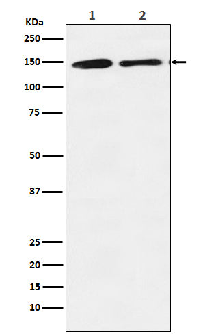 Anti-mSin3A Rabbit Monoclonal Antibody Boster Bio