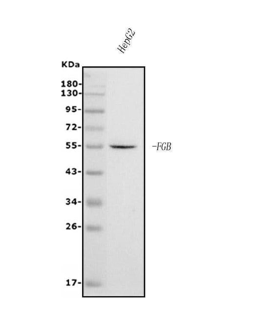 Anti-Fibrinogen beta chain/FGB Antibody Picoband® (monoclonal, 6D12 Boster Bio