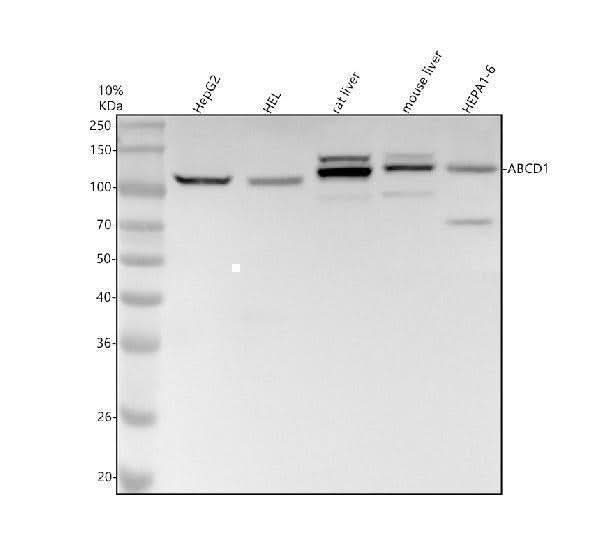 Anti-ABCD1 / ALD Rabbit Monoclonal Antibody Boster Bio