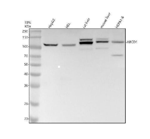 Anti-ABCD1 / ALD Rabbit Monoclonal Antibody Boster Bio