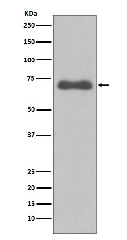 Anti-NUMB Rabbit Monoclonal Antibody Boster Bio