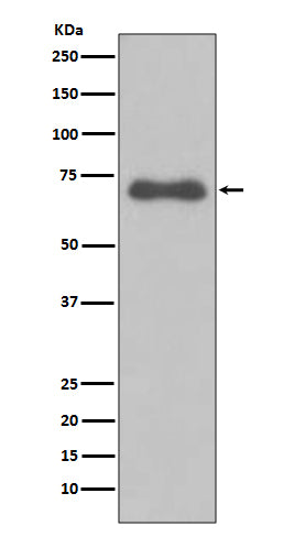 Anti-NUMB Rabbit Monoclonal Antibody Boster Bio