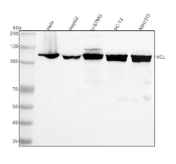 Anti-Vinculin VCL Rabbit Monoclonal Antibody Boster Bio