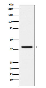 Anti-RING2 / RING1B / RNF2 Rabbit Monoclonal Antibody Boster Bio