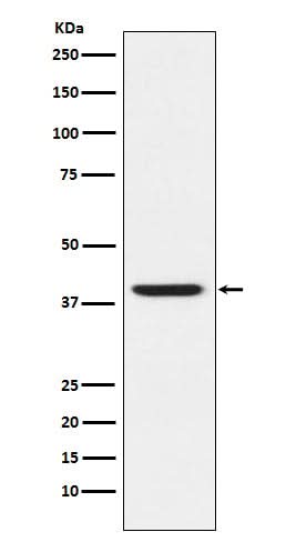 Anti-RING2 / RING1B / RNF2 Rabbit Monoclonal Antibody Boster Bio