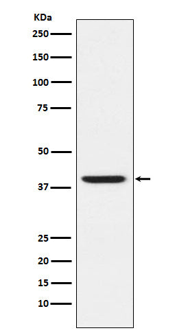 Anti-RING2 / RING1B / RNF2 Rabbit Monoclonal Antibody Boster Bio