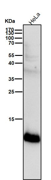 Anti-S100A4 Rabbit Monoclonal Antibody Boster Bio