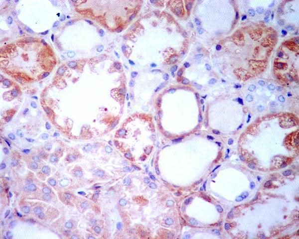 Anti-TGFBI/Beta Ig H3 Rabbit Monoclonal Antibody Boster Bio