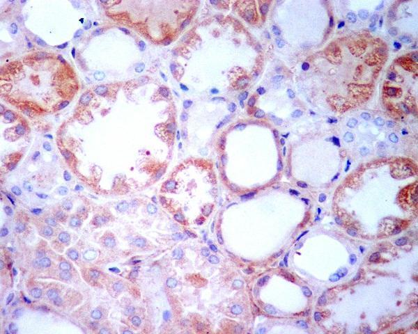 Anti-TGFBI/Beta Ig H3 Rabbit Monoclonal Antibody Boster Bio