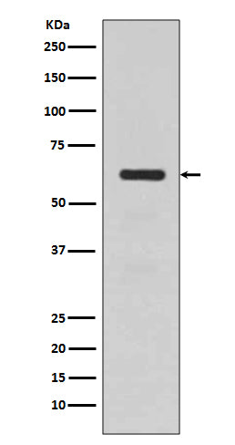 Anti-TGFBI/Beta Ig H3 Rabbit Monoclonal Antibody Boster Bio