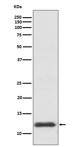 Anti-TRX1 TXN Rabbit Monoclonal Antibody Boster Bio