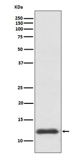 Anti-TRX1 TXN Rabbit Monoclonal Antibody Boster Bio