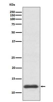 Anti-TRX1 TXN Rabbit Monoclonal Antibody Boster Bio